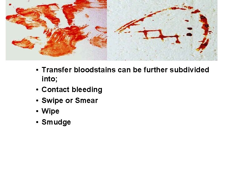  • Transfer bloodstains can be further subdivided into; • Contact bleeding • Swipe