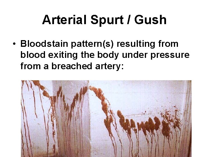 Arterial Spurt / Gush • Bloodstain pattern(s) resulting from blood exiting the body under Arterial Spurt / Gush • Bloodstain pattern(s) resulting from blood exiting the body under