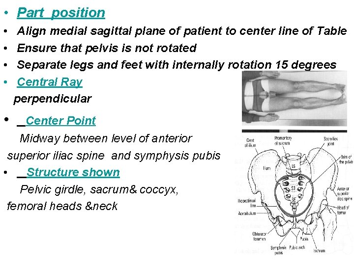  • Part position • • • Align medial sagittal plane of patient to