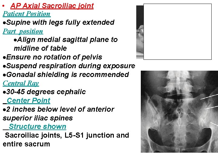  • AP Axial Sacroiliac joint Patient Position Supine with legs fully extended Part