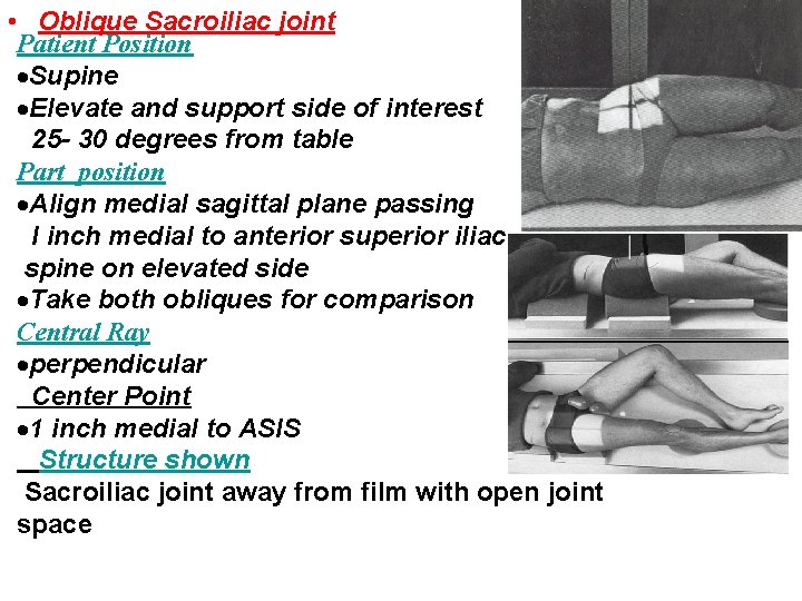  • Oblique Sacroiliac joint Patient Position Supine Elevate and support side of interest