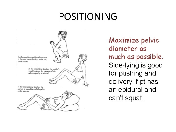 POSITIONING Maximize pelvic diameter as much as possible. Side-lying is good for pushing and