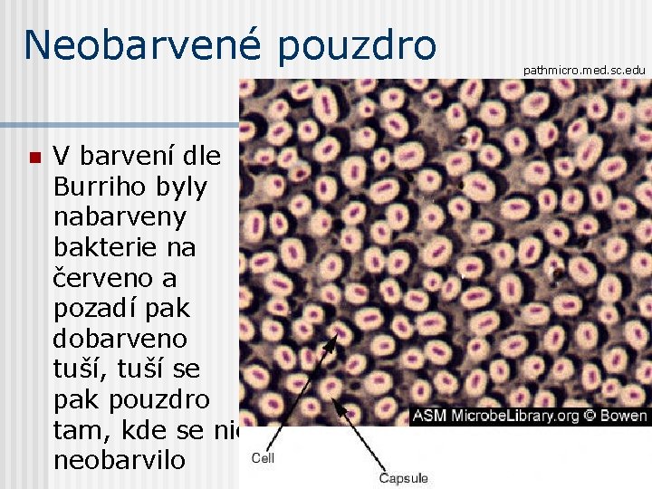 Neobarvené pouzdro n V barvení dle Burriho byly nabarveny bakterie na červeno a pozadí