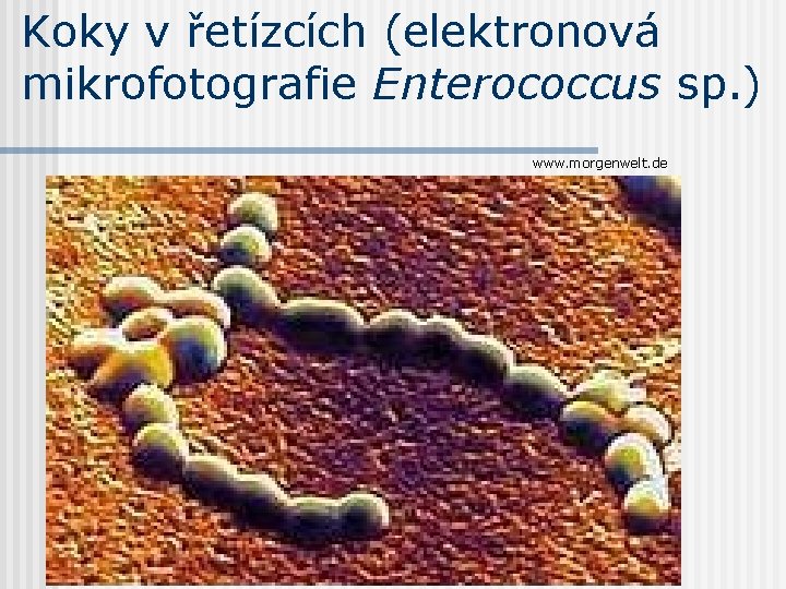 Koky v řetízcích (elektronová mikrofotografie Enterococcus sp. ) www. morgenwelt. de 