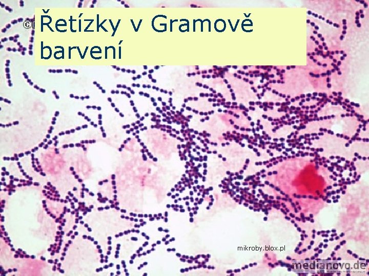Řetízky v Gramově barvení mikroby. blox. pl 