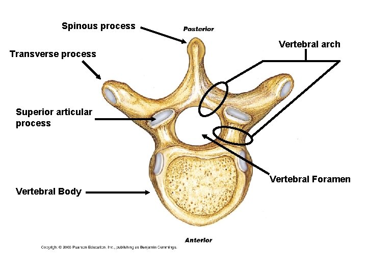 Spinous process Transverse process Vertebral arch Superior articular process Vertebral Foramen Vertebral Body 