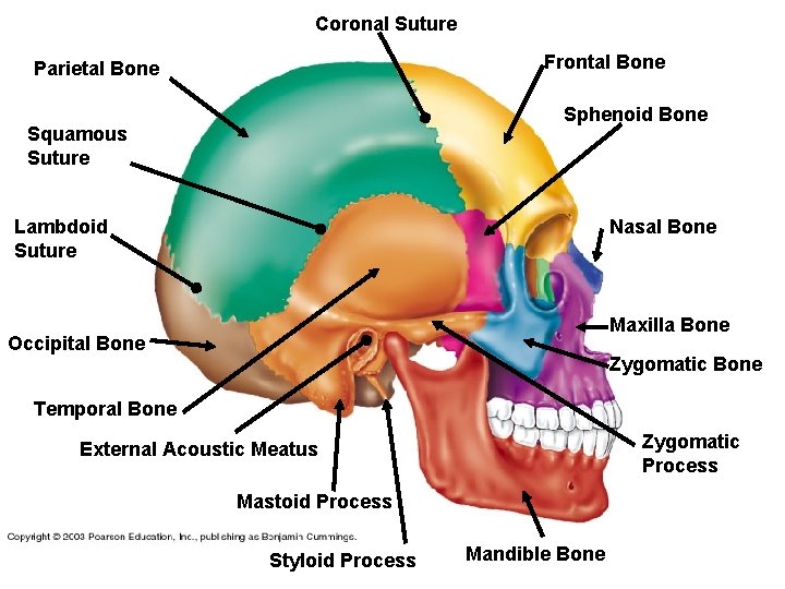 Coronal Suture Frontal Bone Parietal Bone Sphenoid Bone Squamous Suture Lambdoid Suture Nasal Bone