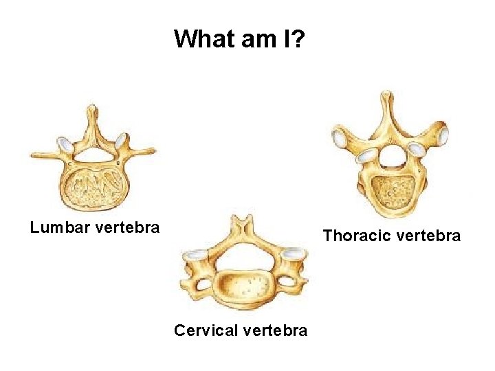 What am I? Lumbar vertebra Thoracic vertebra Cervical vertebra What am I? Lumbar vertebra Thoracic vertebra Cervical vertebra