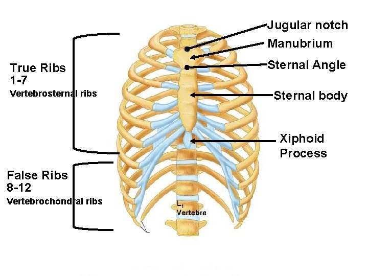 Jugular notch Manubrium True Ribs 1 -7 Vertebrosternal ribs Sternal Angle Sternal body Xiphoid Jugular notch Manubrium True Ribs 1 -7 Vertebrosternal ribs Sternal Angle Sternal body Xiphoid