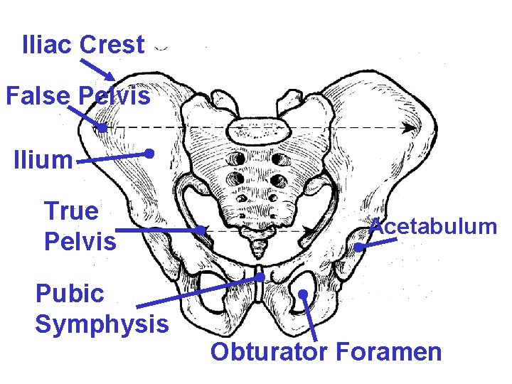 Iliac Crest False Pelvis Ilium True Pelvis Pubic Symphysis Acetabulum Obturator Foramen Iliac Crest False Pelvis Ilium True Pelvis Pubic Symphysis Acetabulum Obturator Foramen