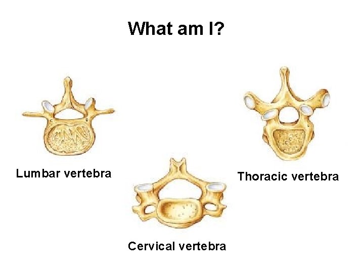 What am I? Lumbar vertebra Thoracic vertebra Cervical vertebra 