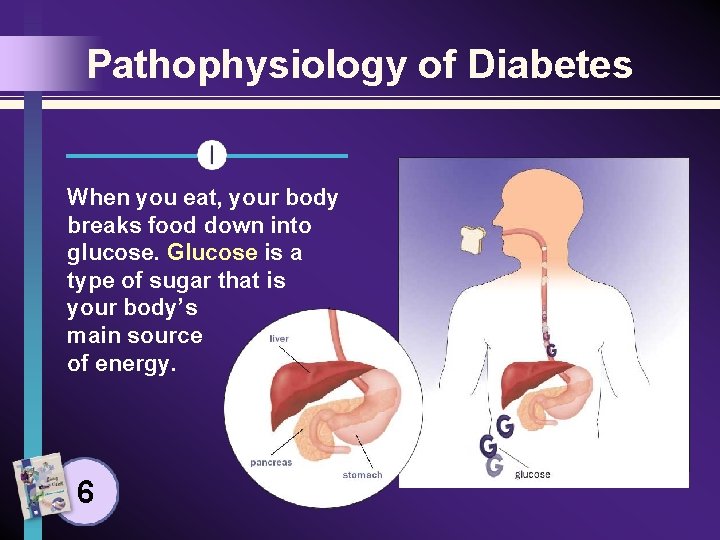 Pathophysiology of Diabetes When you eat, your body breaks food down into glucose. Glucose
