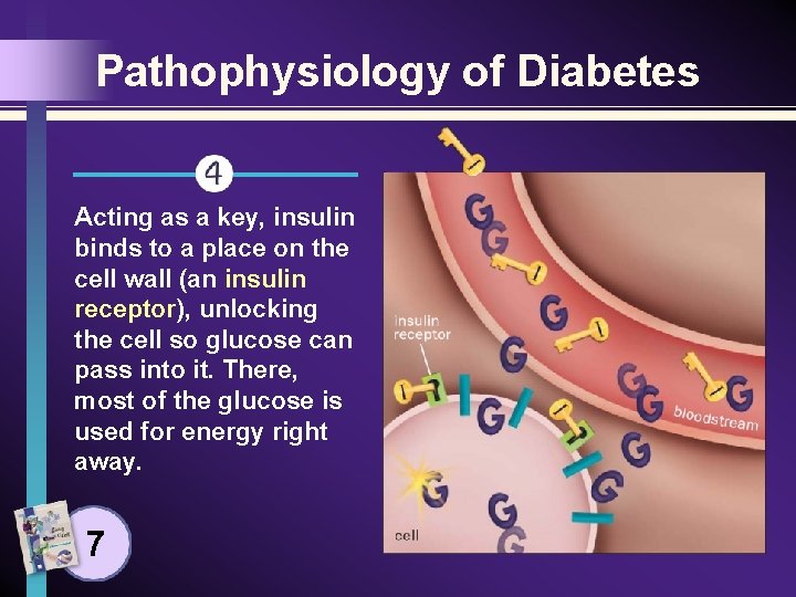 Pathophysiology of Diabetes Acting as a key, insulin binds to a place on the