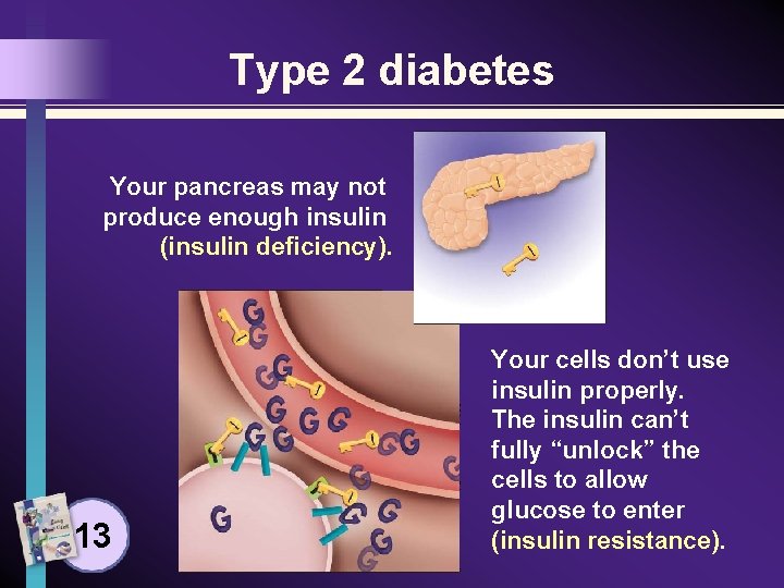 Type 2 diabetes Your pancreas may not produce enough insulin (insulin deficiency). 13 Your