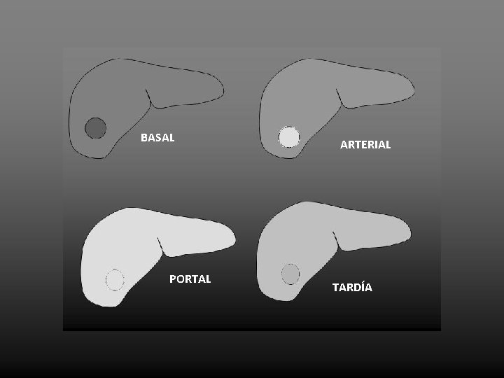 BASAL PORTAL ARTERIAL TARDÍA 