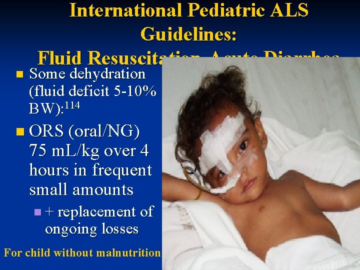 n International Pediatric ALS Guidelines: Fluid Resuscitation-Acute Diarrhea Some dehydration (fluid deficit 5 -10%