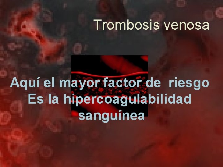 Trombosis venosa Aquí el mayor factor de riesgo Es la hipercoagulabilidad sanguínea 