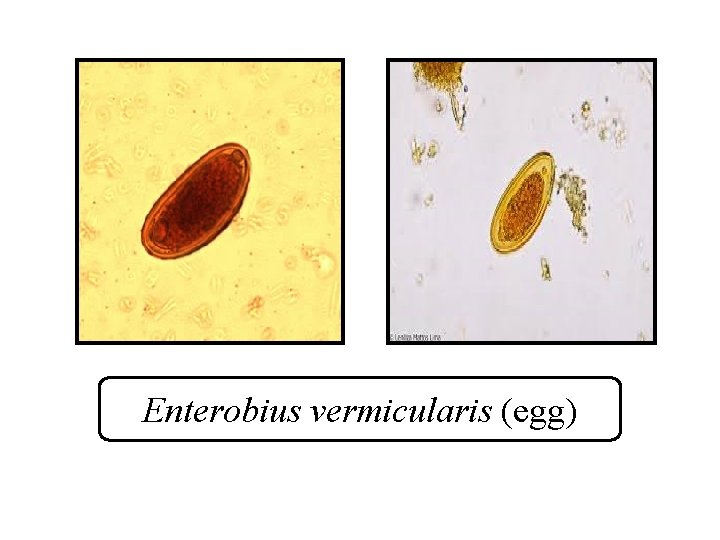 Enterobius vermicularis (egg) 