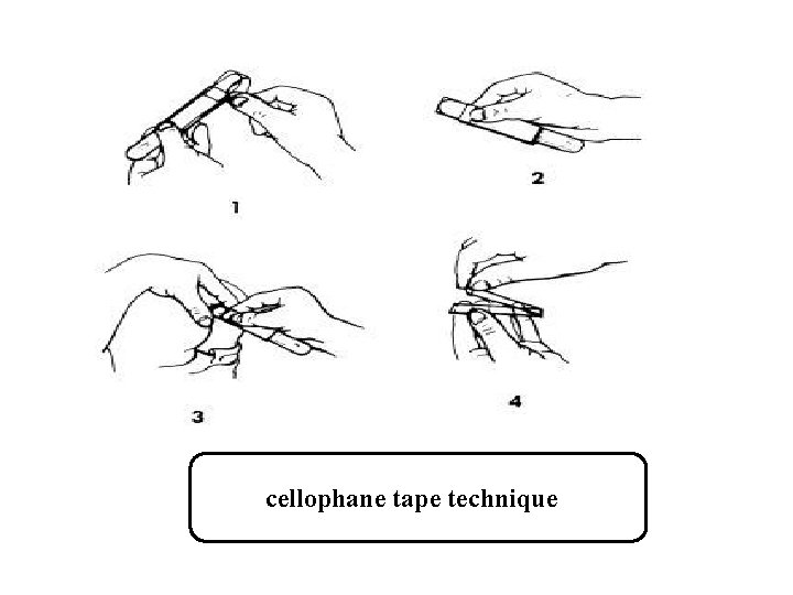 cellophane tape technique 