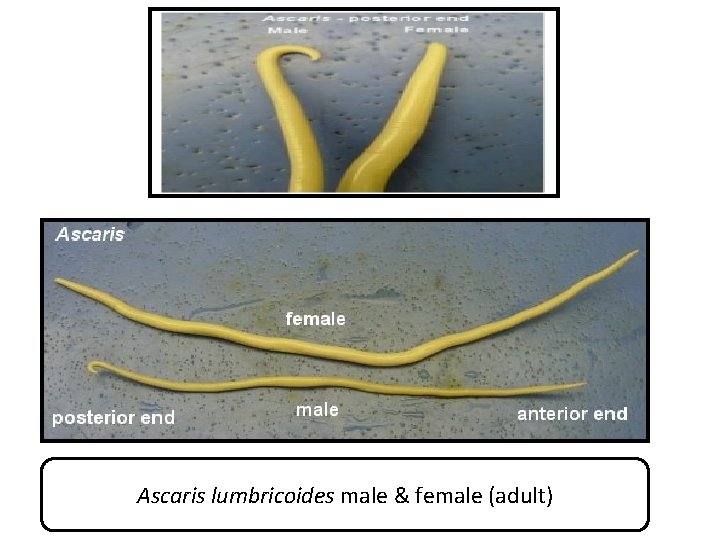 Ascaris lumbricoides male & female (adult) 