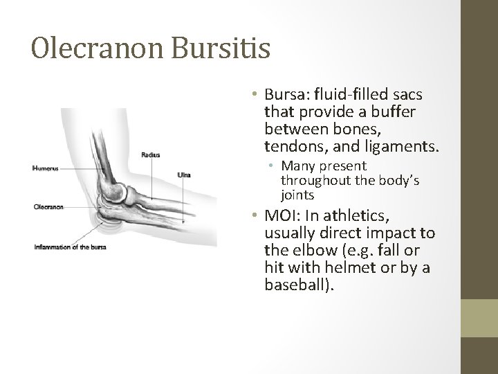 Olecranon Bursitis • Bursa: fluid-filled sacs that provide a buffer between bones, tendons, and
