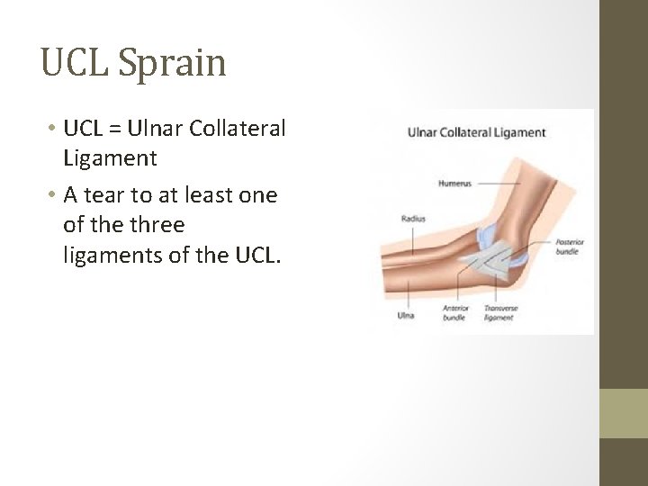 UCL Sprain • UCL = Ulnar Collateral Ligament • A tear to at least