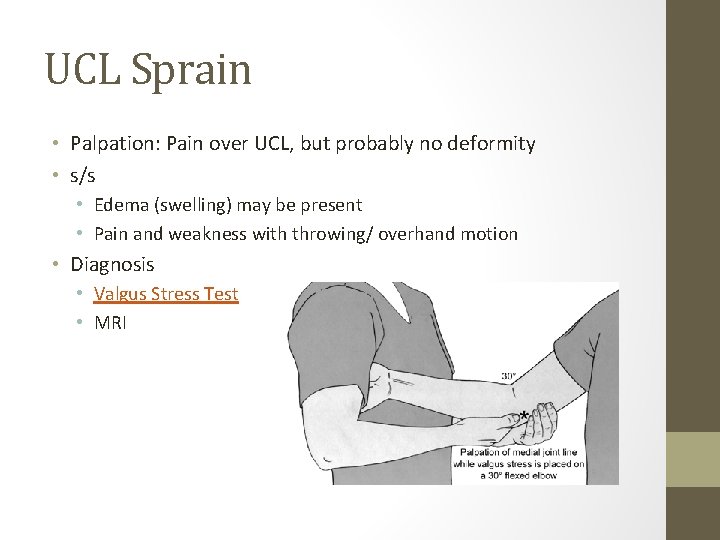 UCL Sprain • Palpation: Pain over UCL, but probably no deformity • s/s •