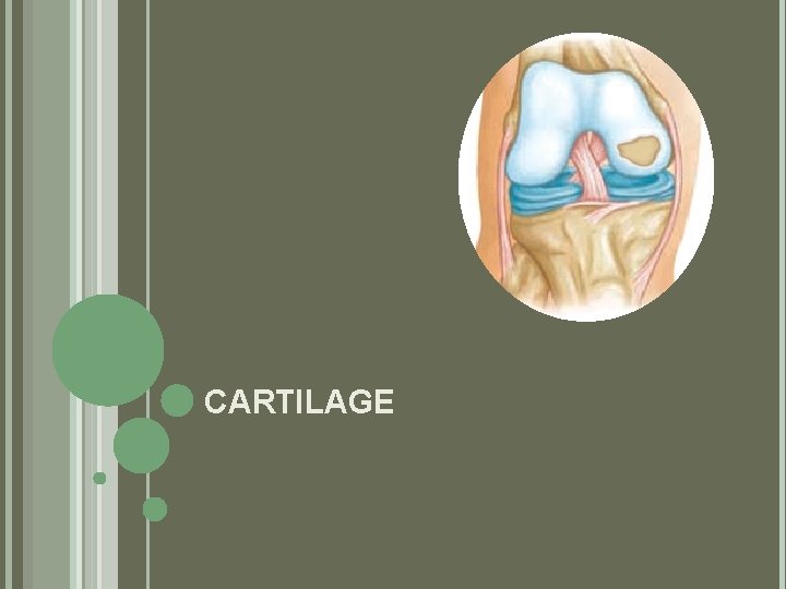 CARTILAGE 