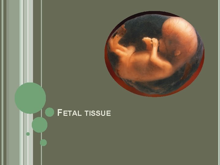 FETAL TISSUE 