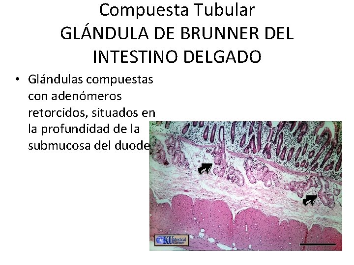 Compuesta Tubular GLÁNDULA DE BRUNNER DEL INTESTINO DELGADO • Glándulas compuestas con adenómeros retorcidos,