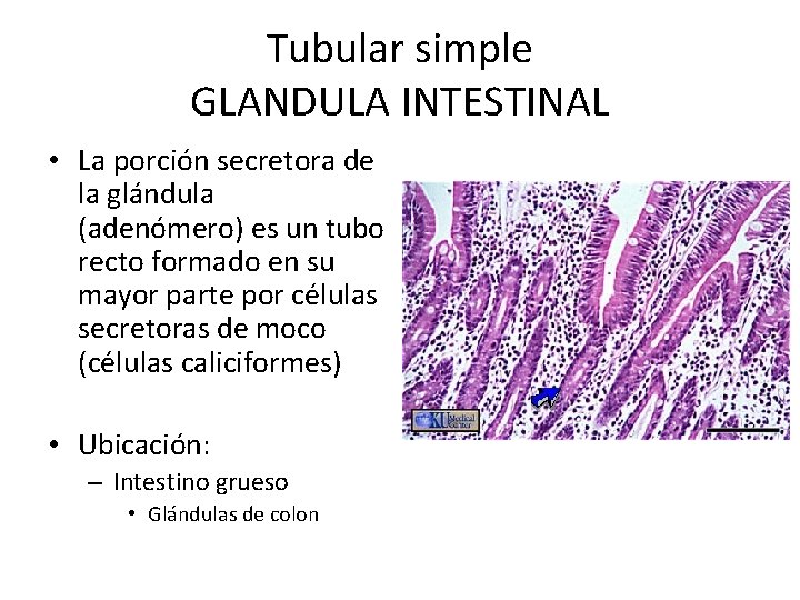 Tubular simple GLANDULA INTESTINAL • La porción secretora de la glándula (adenómero) es un