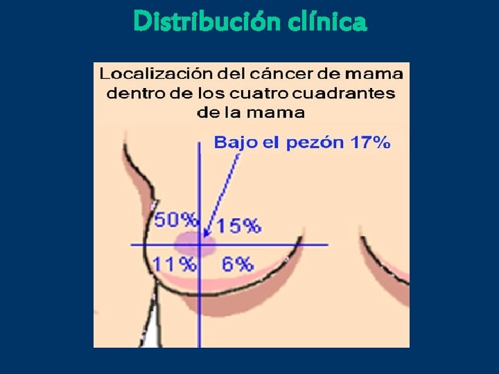 Distribución clínica 