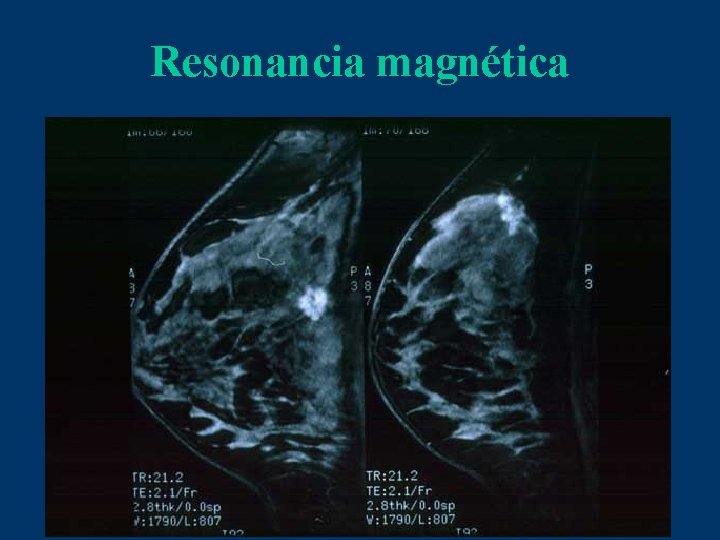 Resonancia magnética 