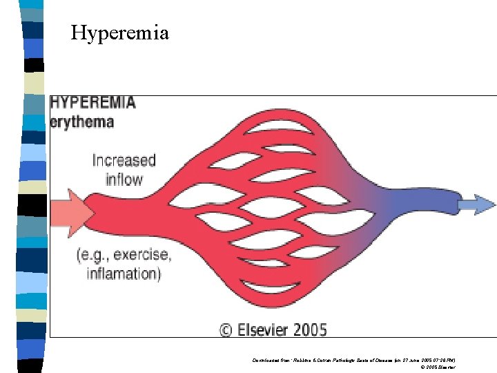 Hyperemia Downloaded from: Robbins & Cotran Pathologic Basis of Disease (on 27 June 2005