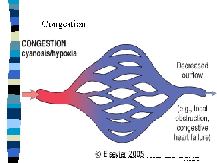 Congestion Downloaded from: Robbins & Cotran Pathologic Basis of Disease (on 27 June 2005