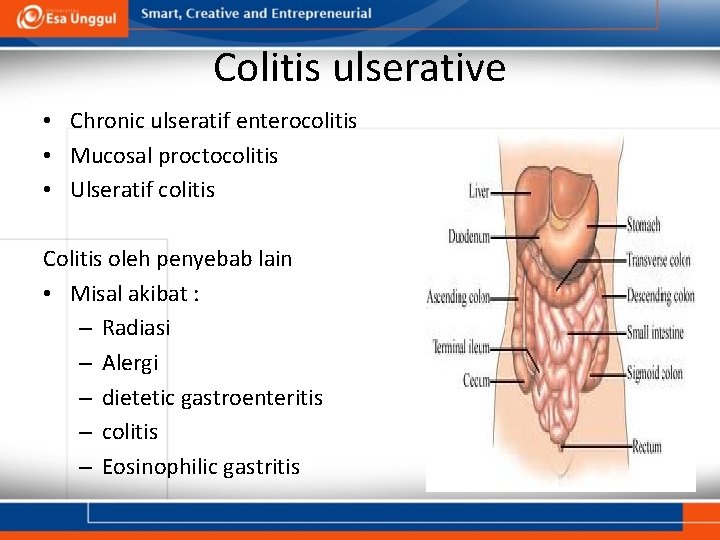 Colitis ulserative • Chronic ulseratif enterocolitis • Mucosal proctocolitis • Ulseratif colitis Colitis oleh