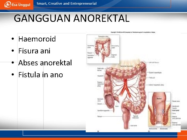 GANGGUAN ANOREKTAL • • Haemoroid Fisura ani Abses anorektal Fistula in ano 