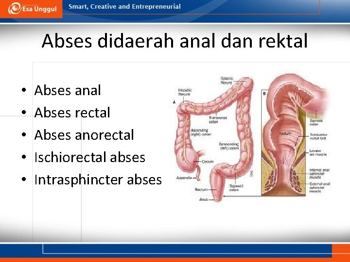 Abses didaerah anal dan rektal • • • Abses anal Abses rectal Abses anorectal