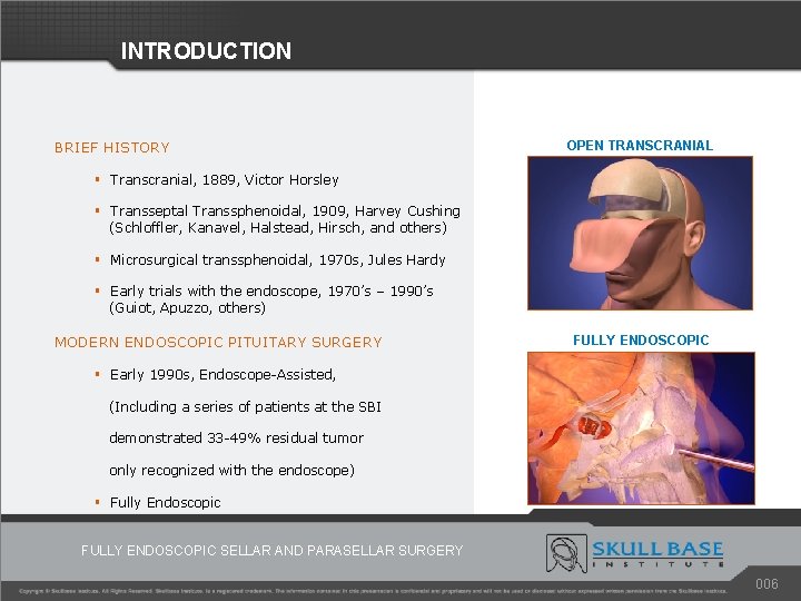 INTRODUCTION BRIEF HISTORY OPEN TRANSCRANIAL § Transcranial, 1889, Victor Horsley § Transseptal Transsphenoidal, 1909,