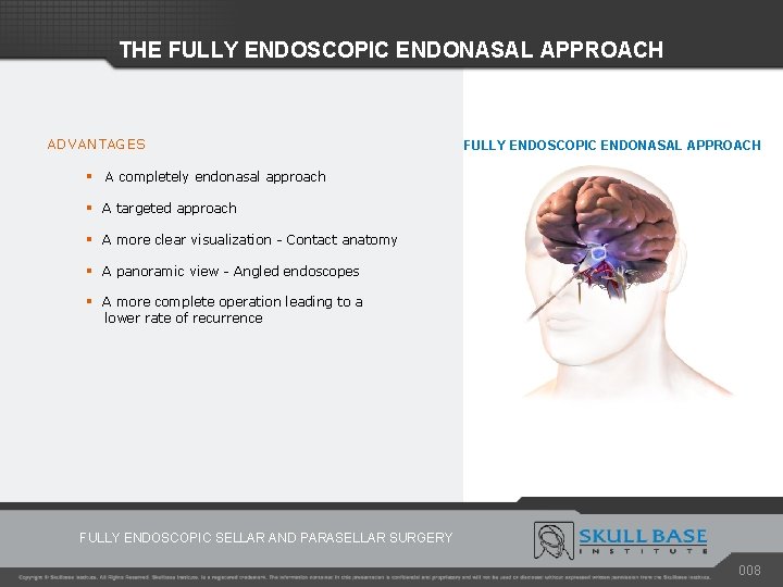 THE FULLY ENDOSCOPIC ENDONASAL APPROACH ADVANTAGES FULLY ENDOSCOPIC ENDONASAL APPROACH § A completely endonasal