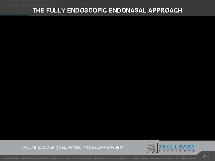 THE FULLY ENDOSCOPIC ENDONASAL APPROACH OPERATIVE TECHNIQUE FULLY ENDOSCOPIC SELLAR AND PARASELLAR SURGERY 014