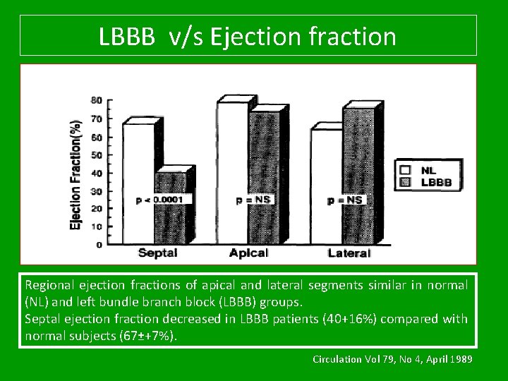 LBBB v/s Ejection fraction Regional ejection fractions of apical and lateral segments similar in