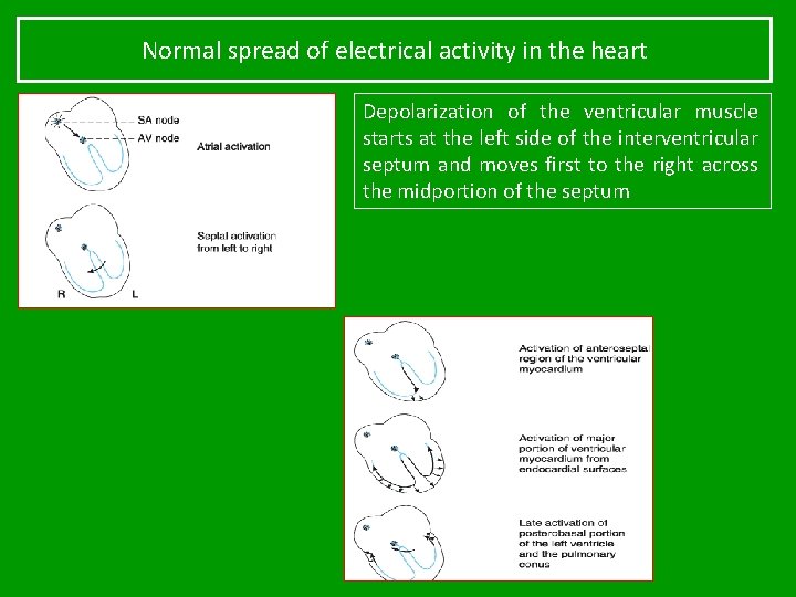 Normal spread of electrical activity in the heart Depolarization of the ventricular muscle starts
