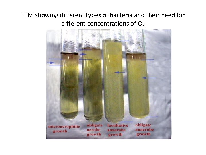 FTM showing different types of bacteria and their need for different concentrations of O₂