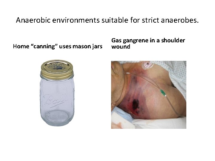 Anaerobic environments suitable for strict anaerobes. Home “canning” uses mason jars Gas gangrene in