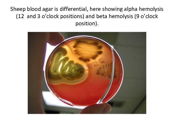 Sheep blood agar is differential, here showing alpha hemolysis (12 and 3 o’clock positions)