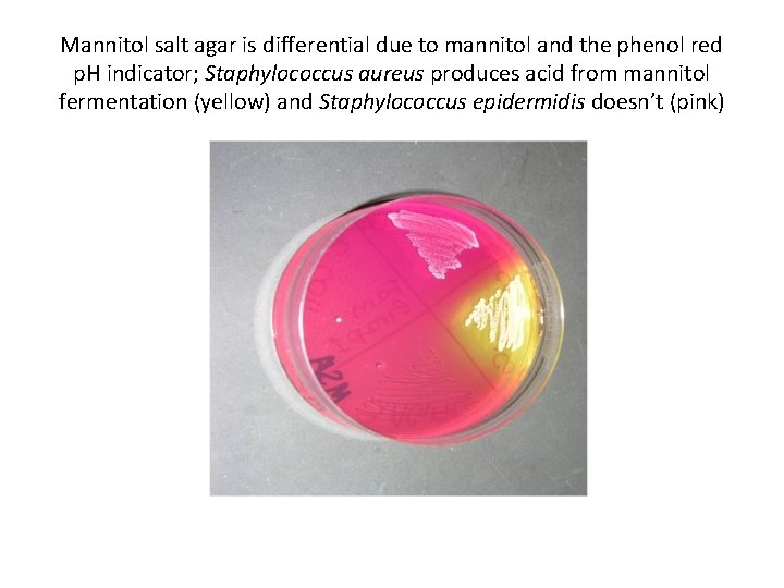 Mannitol salt agar is differential due to mannitol and the phenol red p. H