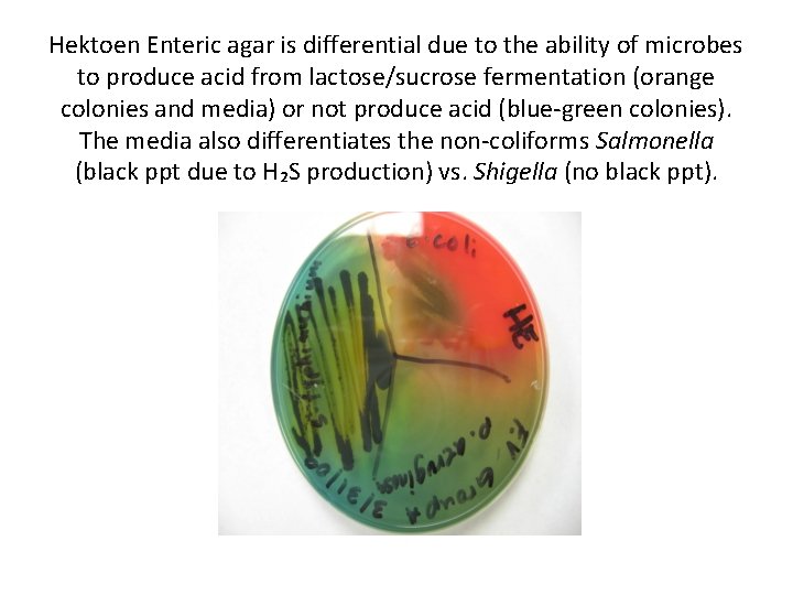 Hektoen Enteric agar is differential due to the ability of microbes to produce acid