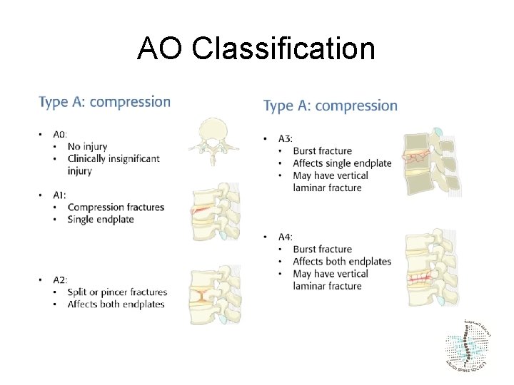 AO Classification 