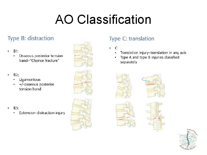 AO Classification 